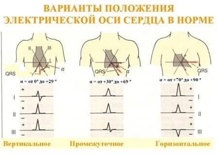 elektrokardiografiya-min